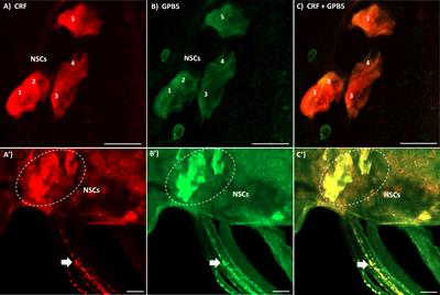 Corticotropin-releasing factor-like diuretic hormone acts as a gonad-inhibiting hormone in adult female, Rhodnius prolixus